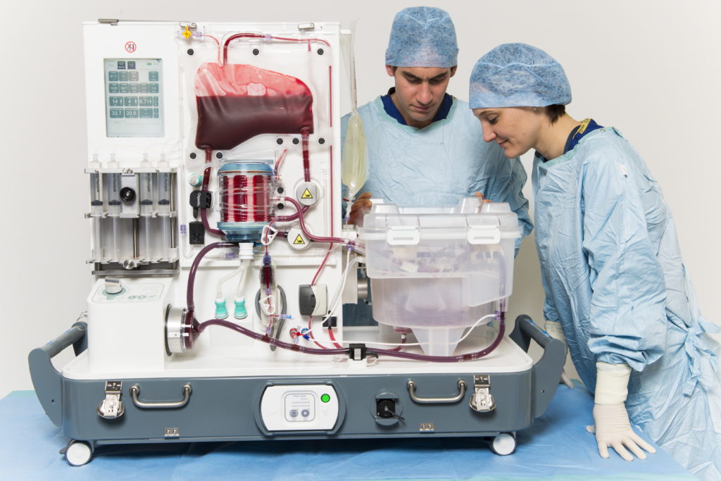The final OrganOx device with surgeons 